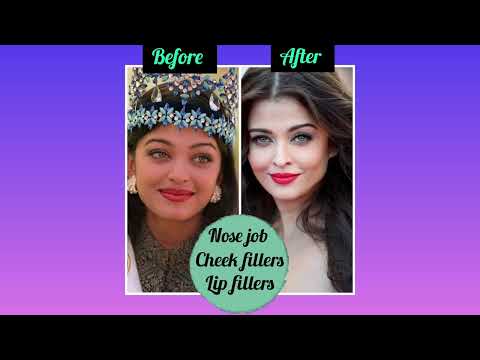 Celebrities plastic surgery before and after pics|Trisha|Samantha|Tapsee|Aishwarya Rai|Shreya