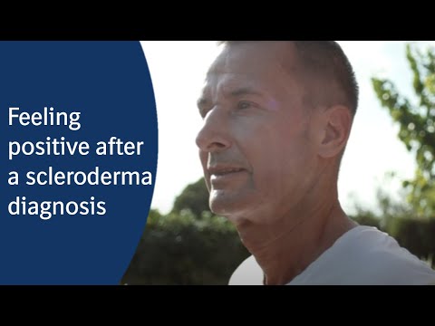 Life after scleroderma diagnosis