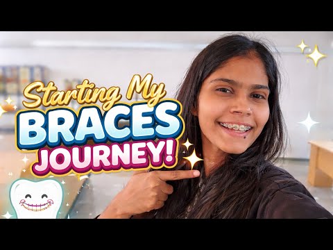 “Braces on, smile loading… 😁🦷”  Appointment Day  #vlog  #DentalAppointment #SmileCare  #TeethCheck 