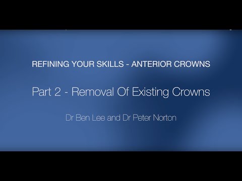 Anterior Crowns - Part 2: Removal of Existing Crowns
