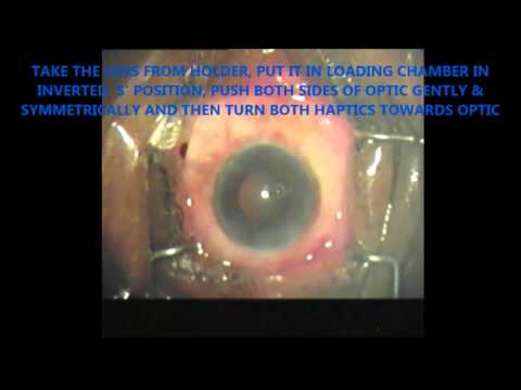 LOADING & IMPLANT VIDEO HYDROPHOBIC C SERIES