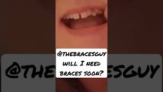 @TheBracesGuy