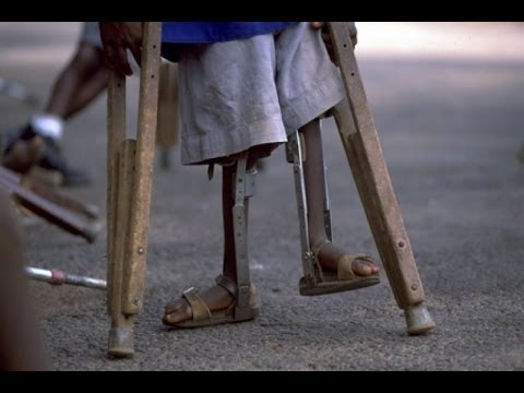 Polio Documentary - The Vaccine That Changed The World - World Documentary HD