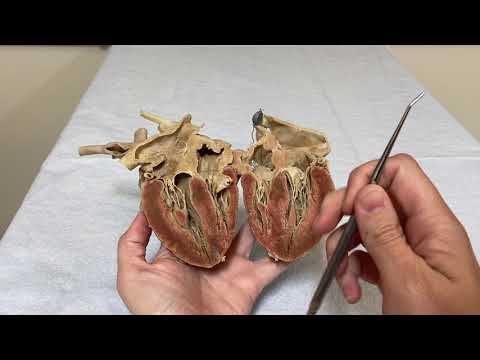 Coronary Vessels