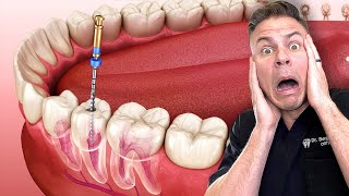 Dentist Reveals What REALLY Happens In A Root Canal!