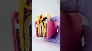 iDENTical Caries V/S Healthy Teeth Model M4021 - Dental Education Tool  #anatomy #dentalkart