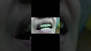 #dentalhealth #dentist #dentistry