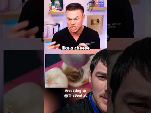 How would YOU react if ‎⁨@Thebentist did your root canal??? #cheese #rootcanal #dentist