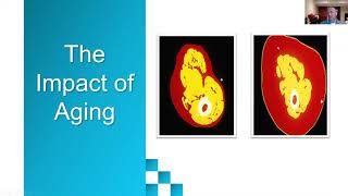 Dr. Darren Candow - Aging Process and the Importance of Dietary Protein