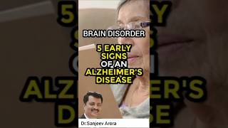 why you forget  things ?  #amazingfacts #health #brain #forget #deepknowledge