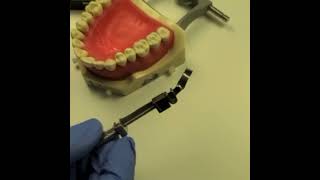 Clinical tip to avoid breaking tofflemire during Deep Margin Elevation by Pascal Magne