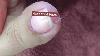 Pedicure December 22 #satisfying Neldz SOLO Parent  is live!