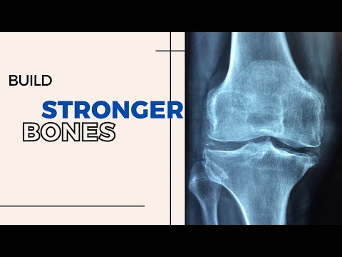 How To Treat Osteoporosis: 11 Ways to Build Stronger Bones
