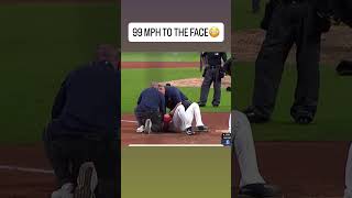 99 MPH to the face😳 #baseball #mlb #professionalbaseball #sports #wow #baseballplayer