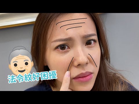 [尼斯診所]法令紋很深 幫你快速改善