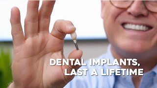 Dental Implants: What You Need to Know  | Rice Dentistry | Dentist in Irvine, California