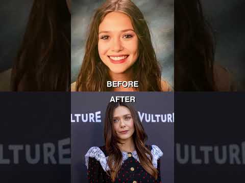 Elizabeth Olsen’s Glow-Up from Indie Star to MCU Queen 👑🔥