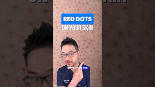Keratosis pilaris #skincare