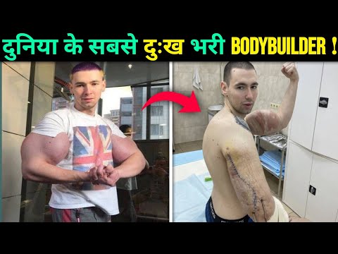 Top 5 Bodybuilders Whose Bodies Are Destroyed by Injections 😱