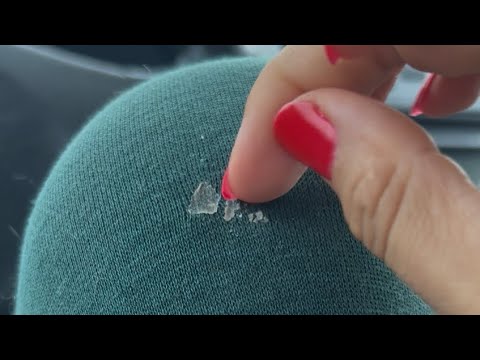 Picking and Scratching Dried Spot ASMR