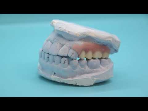 Elevator Pitch-Removable Dept-An Intro to the Removable Dept at Utica Dental Lab