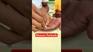 How To Remove Feviquick From Hand? #tricks #shorts