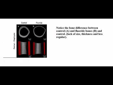 Cutting Out Fluoride For Losing Weight And Saving Your Mind