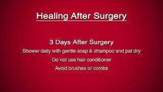 Deep Brain Stimulation (DBS): Post-surgery Care