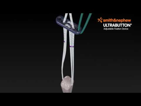 ULTRABUTTON Anwendung Animation (Englisch)
