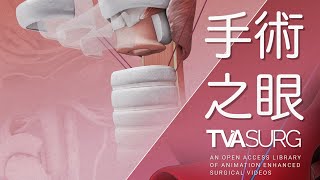 The Surgical Eye | TVASurg x NTUH Exhibition