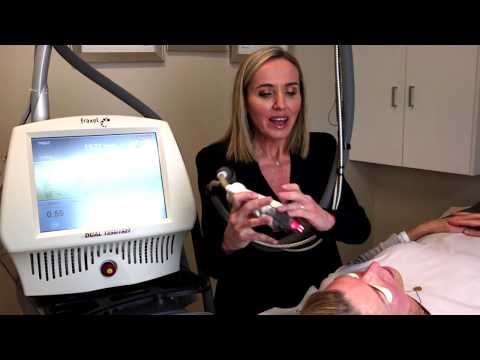 Dr Nina Wines - Fraxel Laser Treatment