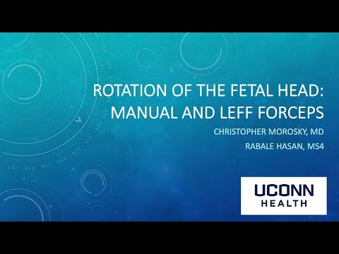 Rotation of the Fetal Head: Manual and Leff Forceps