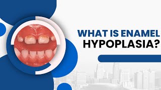 What is Enamel Hypoplasia? (2 Huge Factors Causing it)