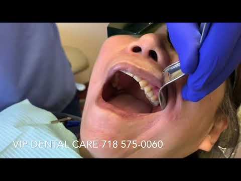 Dental Implant Crown. Screw Retained vs Cement Retained