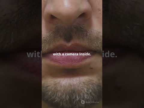 Capsule endoscopy #science