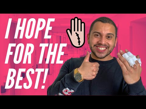 Getting My Hand Cut Recovered | Quarantine Day In My Life