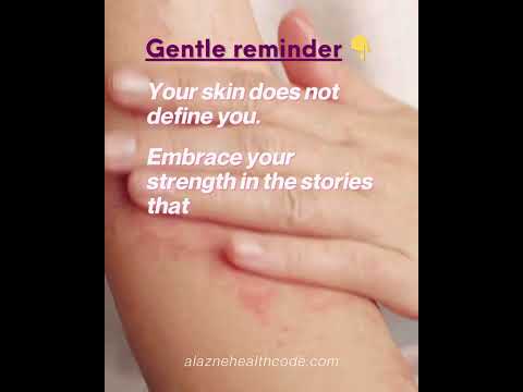 ‼️ PSA ‼️Dear skin condition sufferers and warriors, your worth is NOT defined by your skin ❣️