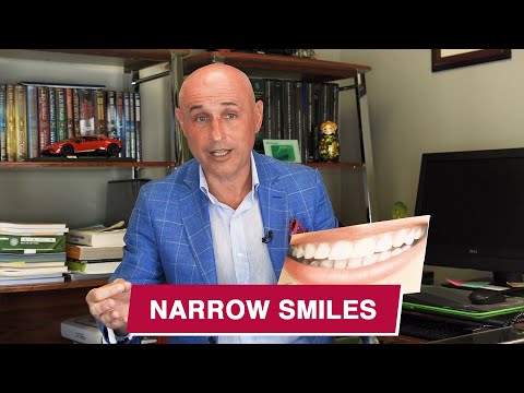 Narrow smiles & arches: how we can fix, broaden & perfect