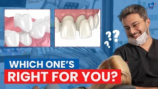 Dental Crowns vs Veneers in Antalya, Turkey (Here's How to Decide!)
