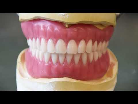 Part of the Process - Setting Denture Teeth for a Wax Try-In