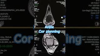 #techlearner #anatomy #mriplanning #cardiacmri