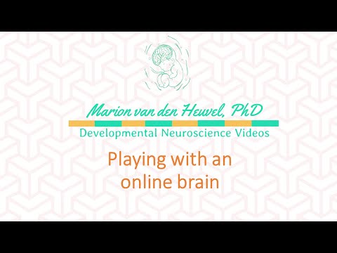 [NEUROANATOMY TIPS] Playing with an ONLINE brain