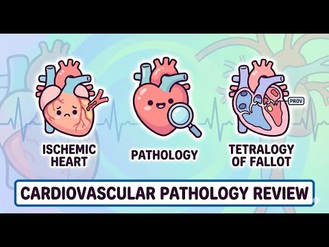 PLE REVIEW 6.5◦ Cardiovascular Pathology