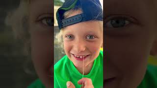 Loose Tooth VS. Stomp Rocket #comedyshorts #loosetooth  #satisfyingvideo #funnyvideos #funnyshorts