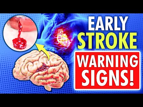 10 WARNING SIGNS of STROKE ONE MONTH BEFORE ( Don't Ignore Them!)
