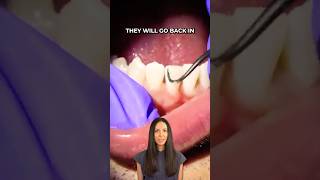 scaling teeth with ultrasonic water #shorts #dentist