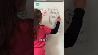 Ulcerative Colitis vs. Crohn’s Disease #RN #BSN #futurenurse