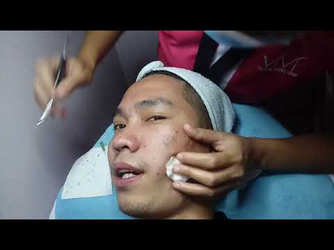 How to cure pimples outbreak?