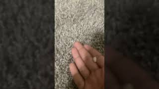 My baby tooth fall out
