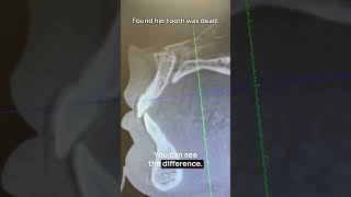 Found her tooth was dead #shorts